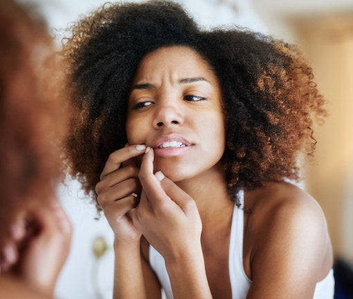 5 mistakes you might be making when trying to conceal a pimple